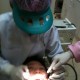 อ้าปากให้คุณหมอขูดหินปูนใต้เหงือก